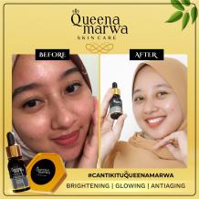 QUEENA MARWA FACIAL SOAP 30 gr