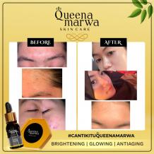 QUEENA MARWA FACE SERUM PENCERAH WAJAH